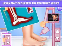 Nail Surgery Foot Toe Doctor Screen Shot 12
