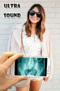 Ultrasound X-ray Scanner Prank Screen Shot 1