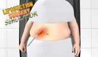 Liposuction Surgery Simulator Screen Shot 2