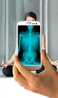 Amazing Body X-Ray Prank Screen Shot 0