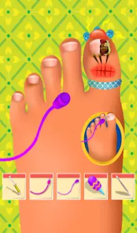 Feet Hospital Operating Games Screen Shot 2