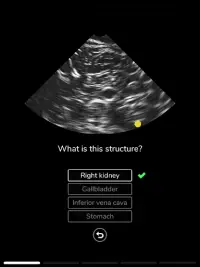 Deepscope Ultrasound Simulator Screen Shot 10