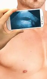 Ultrasound Scanner (Prank) Screen Shot 3