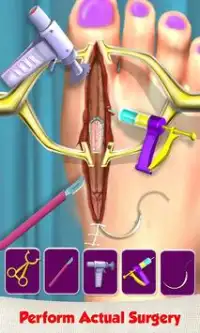 足の手術の病院のシミュレータ：ER医者のゲーム Screen Shot 1