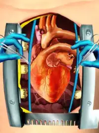 Open Heart Surgery Simulator Screen Shot 11