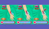腕手術 - ドクターゲーム Screen Shot 2