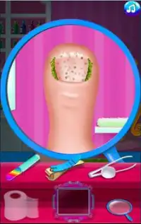 Miraculous Ladybug Nail_Foot Surgery Master Jogos Screen Shot 1