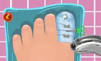 Toe Surgery Doctor Game Screen Shot 6