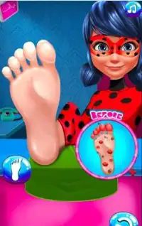 Miraculous Ladybug Nail_Foot Surgery Master Jogos Screen Shot 4