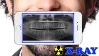 X-Ray Filter Photo Screen Shot 1