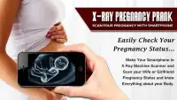 Xray Scanner Pregnant Prank New Screen Shot 3