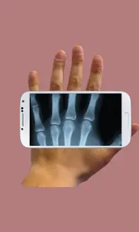X-ray Cam Prank Screen Shot 1