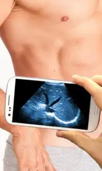 Ultrasound Scanner (Prank) Screen Shot 2
