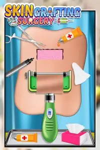 How to perform Skin Grafting Surgery Screen Shot 3