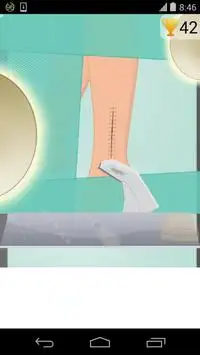 足の手術ゲーム Screen Shot 6
