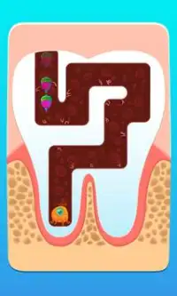 My Dentist Game (私の歯医者ゲーム) Screen Shot 2