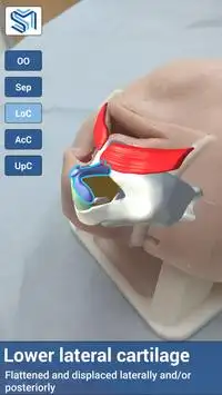 Simulare Medical Screen Shot 3