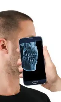 X-ray Human Scanner: Prank Screen Shot 2