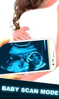 Baby Ultrasound Scanner :Prank Screen Shot 0