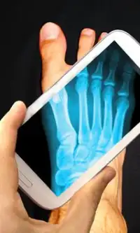 Jelly Phone X-Ray :Prank Screen Shot 2