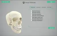 Virtual Cranium Screen Shot 5