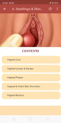 All Vaginal Problems & Solutions Screen Shot 5