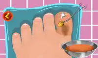 Toe Surgery Doctor Game Screen Shot 3