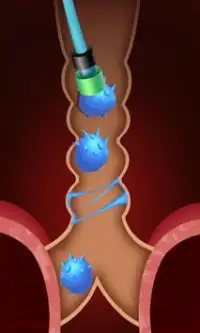 Princess Mommy's Lungs Cure Screen Shot 2