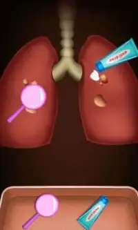 cirurgia Princesa do pulmão Screen Shot 2