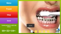 Mombrush Pro Lite Orthodontic Screen Shot 1