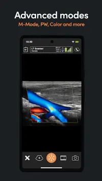 App Clarius Ultrasound Screen Shot 3