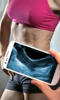 Ultrasound Scanner (Prank) Screen Shot 0